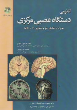 آناتومي دستگاه عصبي مركزي همراه با مقاطع مغز و تصاوير ct و mrl  