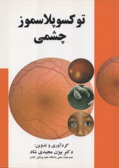 توكسوپلاسموز چشمي  